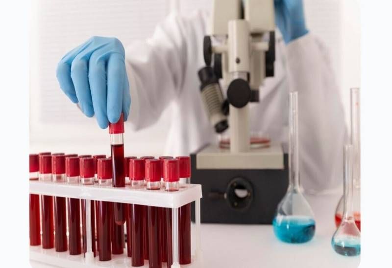 महालॅबच्या महापराक्रमाने जिल्ह्यातील आरोग्य विभाग सलाईन वर : सदोष तपासणी अहवालामुळे रुग्णांना मनस्ताप